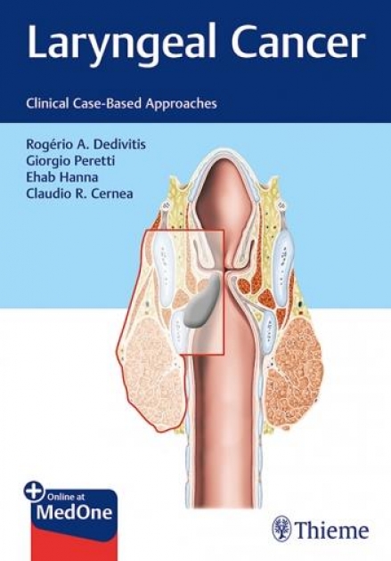 Laryngeal Cancer Dedivitis