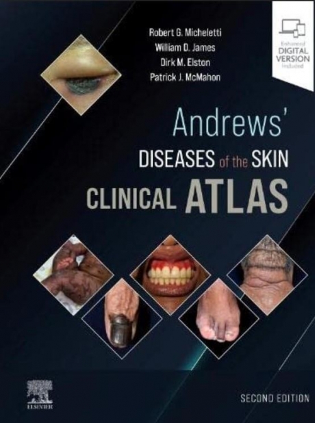 Andrews` Diseases of the Skin Clinical Atlas, 2nd Edition