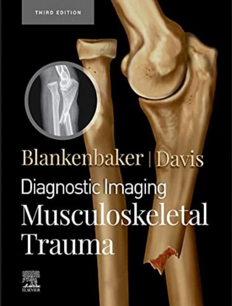 Diagnostic Imaging: Musculoskeletal Trauma, 3rd Edition
