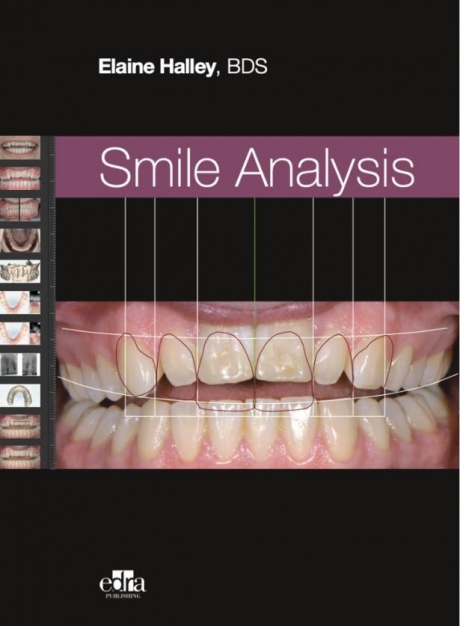Smile Analysis