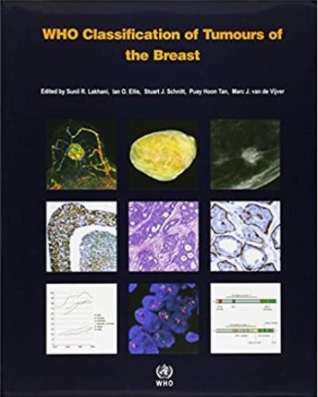 WHO Classification of Tumours of the Breast, 4th Edition