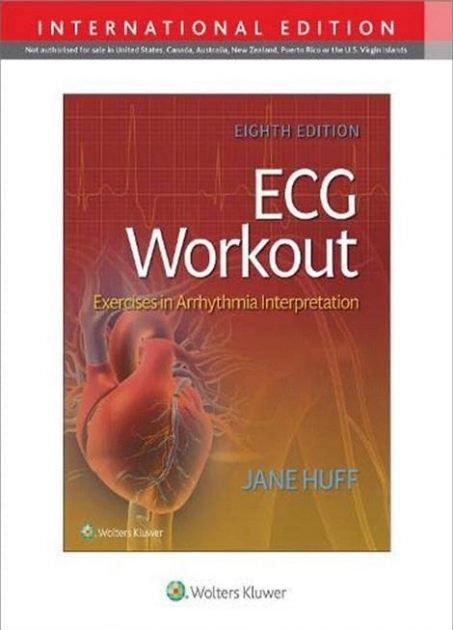 ECG Workout: Exercises in Arrythmia Interpretation, 8th Edition, IE
