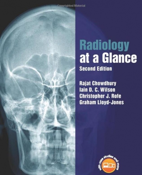 Radiology at a Glance, 2nd Edition