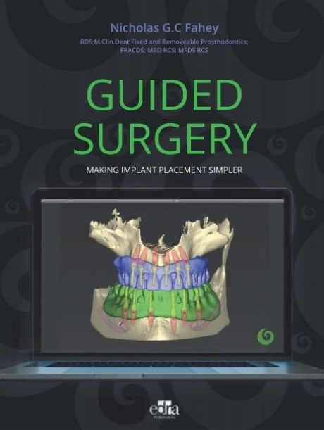 Guided Surgery, 1st Edition
