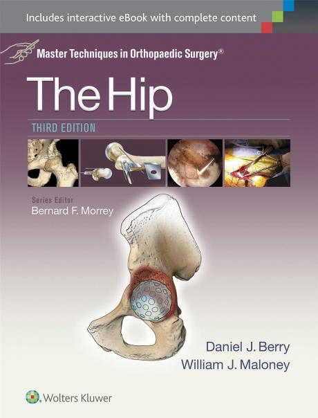 Master Techniques in Orthopaedic Surgery: The Hip, 3rd Edition