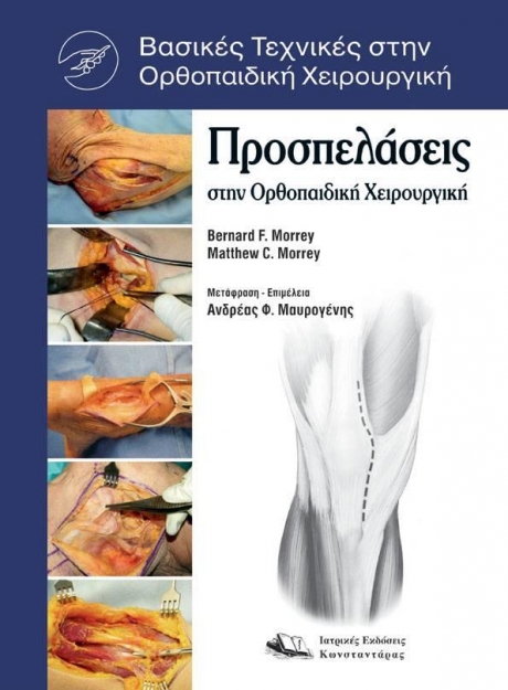 Προσπελάσεις στην Ορθοπαιδική Χειρουργική