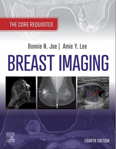 Breast Imaging: The Core Requisites, 4th Edition