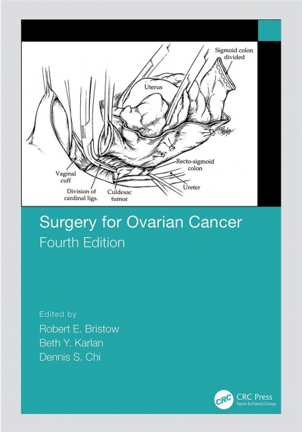 Surgery for Ovarian Cancer, 4th Edition