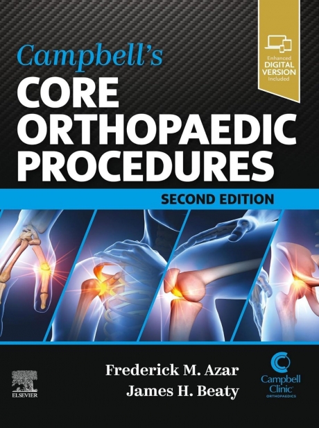 Campbell`s Core Orthopaedic Procedures, 2nd Edition