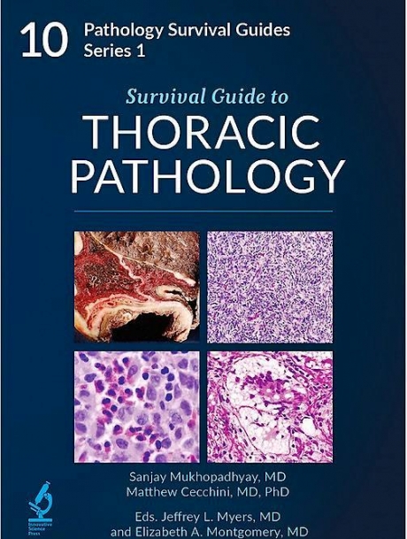 Survival Guide to Thoracic Pathology