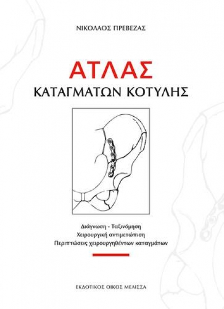 Άτλας Καταγμάτων Κοτύλης
