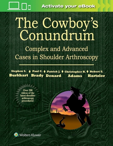 The Cowboy`s Conundrum: Complex and Advanced Cases in Shoulder Arthroscopy
