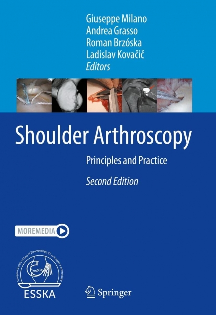 Shoulder Arthroscopy: Principles and Practice, 2nd Edition