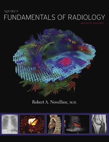 Squire’s Fundamentals of Radiology, 7th Edition