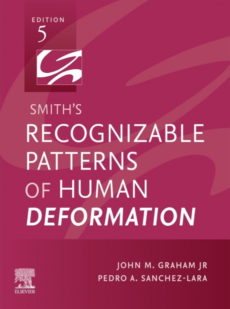 Smith`s Recognizable Patterns of Human Deformation, 5th Edition