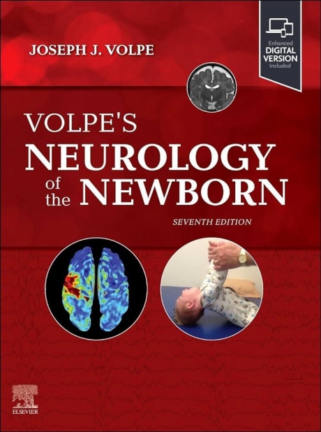 Volpe`s Neurology of the Newborn, 7th Edition