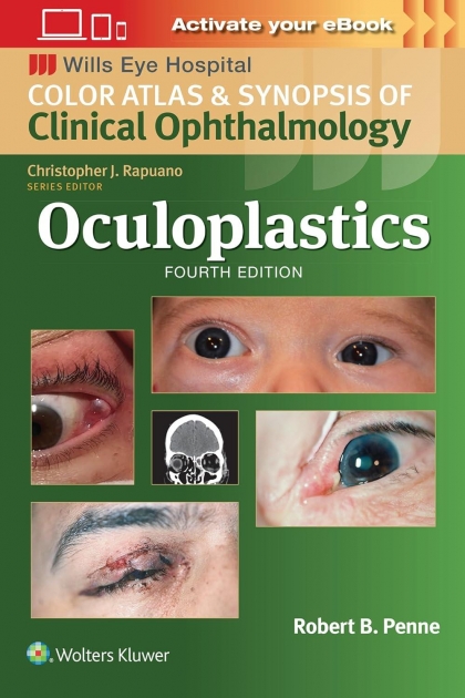 Oculoplastics, Wills Eye Institute Atlas Series, 4th Edition