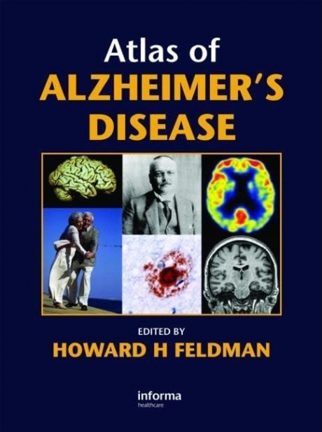 Άτλας της Νόσου του Alzheimer