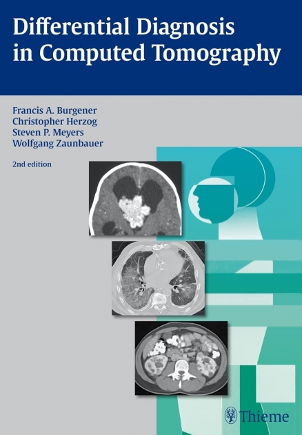 Differential Diagnosis in Computed Tomography, 2nd Edition