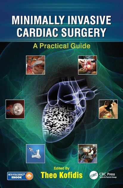Minimally Invasive Cardiac Surgery: A Practical Guide
