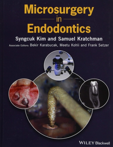 Microsurgery in Endodontics