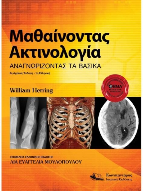Μαθαίνοντας Ακτινολογία